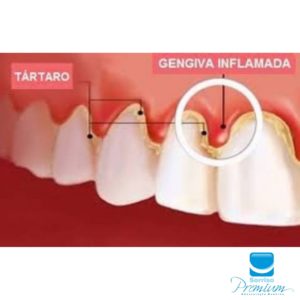 Periodontia - Sorriso Premium